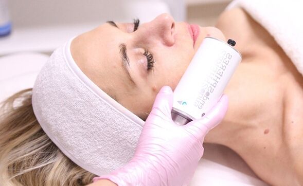 Terapia facial de endosfera para la piel para un efecto rejuvenecedor. 