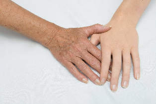 el rejuvenecimiento de la piel de las manos